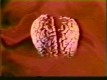 /archive/images/1544shows-brain2.jpg